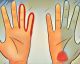 Kribbeln deine Hände? Diese Anzeichen können auf ein gesundheitliches Problem hinweisen!