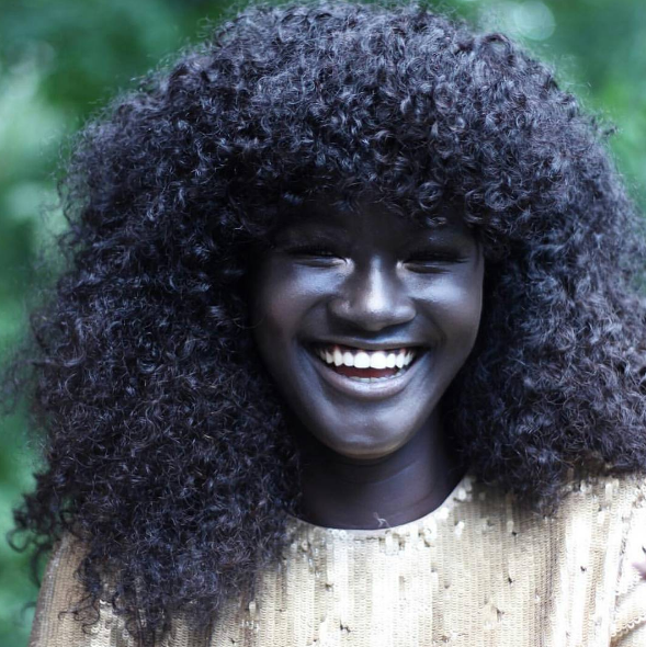 BLACK BEAUTY: Dieses MODEL fasziniert mit einer BESONDEREN Hautfarbe!
