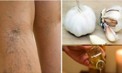 20 Tipps für wunderschöne Beine