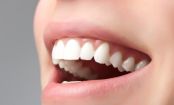 Für ein strahlendes Lächeln: 10 Lebensmittel für weiße Zähne
