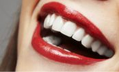 6 natürliche Mittel gegen APHTEN