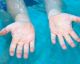 Warum werden die Finger schrumplig, wenn man lange im Wasser ist?