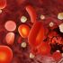 Glukose im Blut – der Blutzuckerspiegel steigt