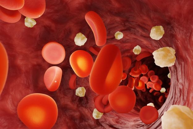 Glukose im Blut – der Blutzuckerspiegel steigt