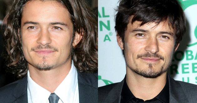 Fellblitz Bürste Für Katzen - Selbstreinigende Haarbürste Mit Edelstahlzähnen